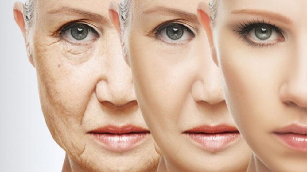 Fine Lines Laser Treatment