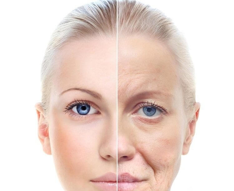 Skin Tightening